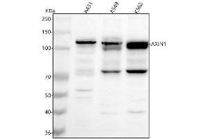 Western blot analysis of AXIN1 using anti-AXIN1 antibody (ABIN7599556).