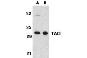 Western Blotting (WB) image for anti-Tumor Necrosis Factor Receptor Superfamily, Member 13B (TNFRSF13B) (N-Term) antibody (ABIN1031600) (TACI 抗体  (N-Term))