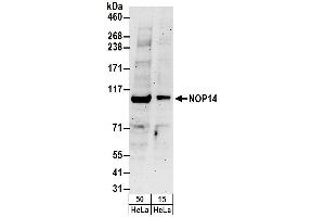 Western Blotting (WB) image for anti-NOP14 Nucleolar Protein (Nop14) (AA 750-800) antibody (ABIN7453145)