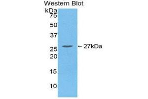 Western Blotting (WB) image for anti-Transforming Growth Factor, beta-Induced, 68kDa (TGFBI) (AA 423-632) antibody (ABIN1860733) (TGFBI 抗体  (AA 423-632))