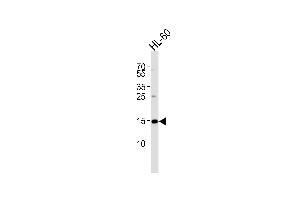 Western blot analysis of lysate from HL-60 cell line, using UBE2L6 Antibody (M1) A.