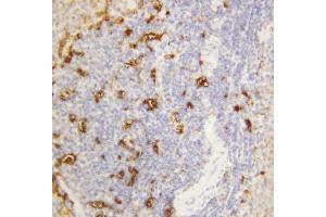 Anti-Alpha Amylase 1 antibody, IHC(P) IHC(P): Rat Spleen Tissue (AMY1A 抗体  (N-Term))