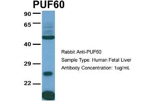 Host:  Rabbit  Target Name:  PUF60  Sample Type:  Human Fetal Liver  Antibody Dilution:  1. (PUF60 抗体  (C-Term))