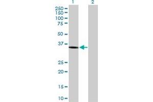 Western Blot analysis of AKR1C1 expression in transfected 293T cell line by AKR1C1 MaxPab polyclonal antibody. (AKR1C1 抗体  (AA 1-323))