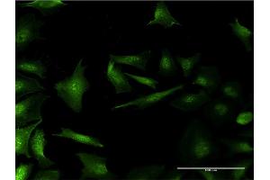 Immunofluorescence of monoclonal antibody to RP2 on HeLa cell. (RP2 抗体  (AA 251-350))