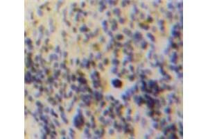 IHC-P analysis of Spleen tissue, with DAB staining. (FGL2 抗体  (AA 20-432))