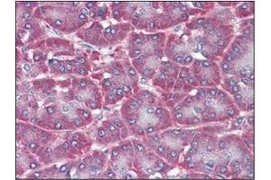 Immunohistochemistry (IHC) image for anti-5'-Nucleotidase, Ecto (CD73) (NT5E) (AA 27-252) antibody (ABIN238367) (CD73 抗体  (AA 27-252))