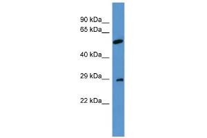 WB Suggested Anti-CABP4 Antibody Titration: 0. (CABP4 抗体  (N-Term))