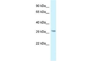 WB Suggested Anti-Gnmt Antibody   Titration: 1. (GNMT 抗体  (N-Term))