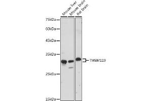 Western blot analysis of extracts of various cell lines, using TMEM119 antibody (ABIN7270953) at 1:1000 dilution. (TMEM119 抗体)
