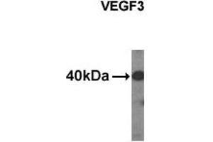 Western Blotting (WB) image for anti-Vascular Endothelial Growth Factor C (VEGFC) (C-Term), (N-Term) antibody (ABIN356356) (VEGFC 抗体  (C-Term, N-Term))