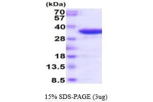 SDS-PAGE (SDS) image for Acid Phosphatase 5, Tartrate Resistant (ACP5) (AA 22-325) (Active) protein (ABIN6387961) (ACP5 Protein (AA 22-325))