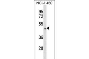 CHST6 Antibody (C-term) (ABIN656284 and ABIN2845594) western blot analysis in NCI- cell line lysates (35 μg/lane). (CHST6 抗体  (C-Term))