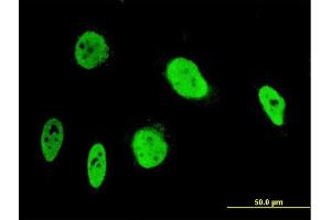 Immunofluorescence of monoclonal antibody to ANKRD17 on HeLa cell. (ANKRD17 抗体  (AA 2501-2603))