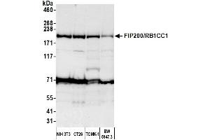 anti-RB1-Inducible Coiled-Coil 1 (RB1CC1) (AA 1544-1594) antibody
