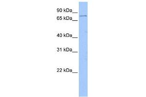 WB Suggested Anti-FOXM1 Antibody Titration:  1 ug/ml  Positive Control:  Jurkat cell lysate (FOXM1 抗体  (Middle Region))