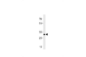 DANREhoxb8b Antibody (C-term) Azb10013a western blot analysis in zebra fish brain tissue lysates (35 μg/lane). (HOXB8 抗体  (C-Term))