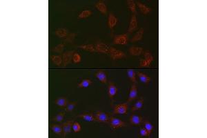 Immunofluorescence analysis of NIH/3T3 cells using [KO Validated] SQSTM1/p62 Rabbit mAb (ABIN7270205) at dilution of 1:50 (40x lens). (SQSTM1 抗体)