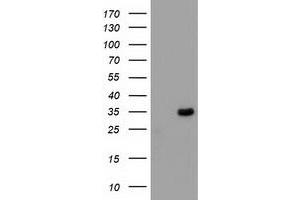 Western Blotting (WB) image for anti-Myeloid Differentiation Primary Response Gene (88) (MYD88) antibody (ABIN1499610) (MYD88 抗体)