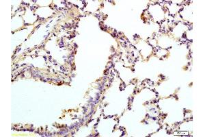 Immunohistochemistry (Paraffin-embedded Sections) (IHC (p)) image for anti-Vasoactive Intestinal Peptide Receptor 1 (VIPR1) (AA 351-457) antibody (ABIN872880)