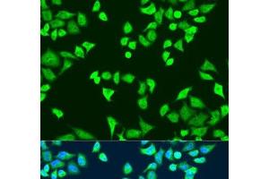 Immunofluorescence analysis of U2OS cells using SMN2 Polyclonal Antibody at dilution of 1:100. (SMN2 抗体)