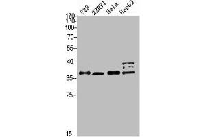 Western blot analysis of 823 22RV1 HELA HEPG2 Cell Lysate, antibody was diluted at 1:2000. (PMEPA1 抗体  (AA 1268-1341))