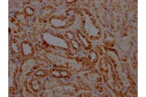 Immunohistochemistry (IHC) image for anti-Signal Transducer and Activator of Transcription 6, Interleukin-4 Induced (STAT6) antibody (ABIN7127828)