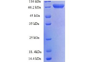 SDS-PAGE (SDS) image for Transglutaminase 2 (C Polypeptide, Protein-Glutamine-gamma-Glutamyltransferase) (TGM2) (AA 4-544), (Isoform 2) protein (His-SUMO Tag) (ABIN5710486)