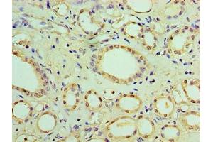 Immunohistochemistry of paraffin-embedded human kidney tissue using ABIN7170991 at dilution of 1:100 (SOCS1 抗体  (AA 1-211))