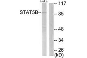 Western Blotting (WB) image for anti-Signal Transducer and Activator of Transcription 5B (STAT5B) (AA 697-746) antibody (ABIN2888609) (STAT5B 抗体  (AA 697-746))