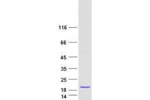 Western Blotting (WB) image for Signal Recognition Particle 14kDa (Homologous Alu RNA Binding Protein) (SRP14) protein (Myc-DYKDDDDK Tag) (ABIN2732665)