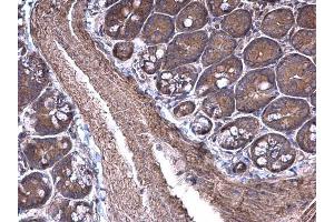 IHC-P Image RPSA antibody [N1C3] detects RPSA protein at cytoplasm on mouse small intestine by immunohistochemical analysis. (RPSA/Laminin Receptor 抗体)