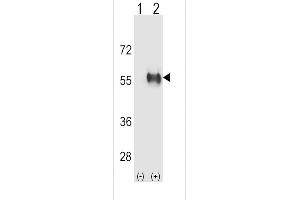 Western blot analysis of ALDH3B1 using rabbit polyclonal ALDH3B1 Antibody using 293 cell lysates (2 ug/lane) either nontransfected (Lane 1) or transiently transfected (Lane 2) with the ALDH3B1 gene. (ALDH3B1 抗体  (AA 334-360))