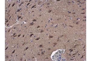 IHC-P Image GOT2 antibody detects GOT2 protein at cytoplasm in mouse brain by immunohistochemical analysis. (GOT2 抗体  (Center))