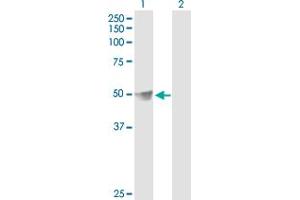 Western Blot analysis of DLST expression in transfected 293T cell line by DLST MaxPab polyclonal antibody. (DLST 抗体  (AA 1-453))