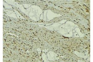 ABIN6277334 at 1/100 staining Mouse muscle tissue by IHC-P. (FBXO32 抗体  (N-Term))