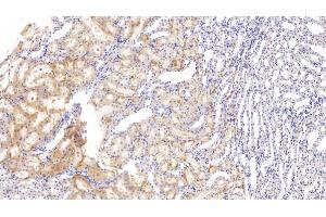 Detection of FXR in Rat Kidney Tissue using Polyclonal Antibody to Farnesoid X Receptor (FXR) (NR1H4 抗体  (AA 375-568))