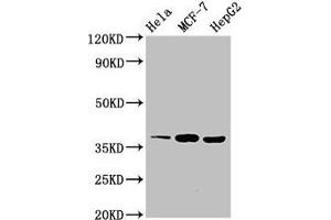Western Blot Positive WB detected in: Hela whole cell lysate, MCF-7 whole cell lysate, HepG2 whole cell lysate All lanes: ALX1 antibody at 3 μg/mL Secondary Goat polyclonal to rabbit IgG at 1/50000 dilution Predicted band size: 37 kDa Observed band size: 37 kDa (ALX1 抗体  (AA 10-304))
