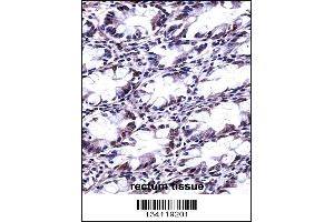 CFL2 Antibody immunohistochemistry analysis in formalin fixed and paraffin embedded human rectum tissue followed by peroxidase conjugation of the secondary antibody and DAB staining. (Cofilin 2 抗体  (N-Term))