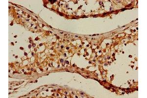 Immunohistochemistry (IHC) image for anti-Glyceraldehyde-3-Phosphate Dehydrogenase (GAPDH) (AA 3-335) antibody (ABIN7154138)