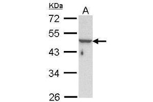 WB Image Sample (30 ug of whole cell lysate) A: Hela 10% SDS PAGE antibody diluted at 1:1000 (Keratin 33B 抗体)