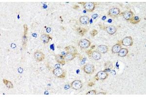 Immunohistochemistry of paraffin-embedded Rat brain using TSC2 Polyclonal Antibody at dilution of 1:200 (40x lens). (Tuberin 抗体)