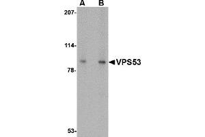 Western Blotting (WB) image for anti-Vacuolar Protein Sorting 53 Homolog (VPS53) (C-Term) antibody (ABIN1030797) (VPS53 抗体  (C-Term))