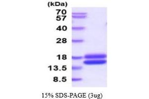 SDS-PAGE (SDS) image for Cystatin C (CST3) (AA 21-140) (Active) protein (His tag) (ABIN7281237)