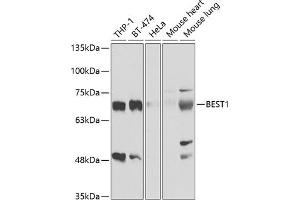 Western blot analysis of extracts of various cell lines, using BEST1 antibody (ABIN6127516, ABIN6137535, ABIN6137537 and ABIN6221403) at 1:1000 dilution. (Bestrophin 1 抗体  (AA 376-585))