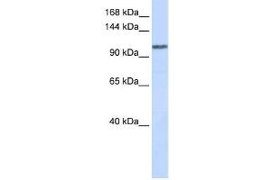 WDR63 antibody used at 1 ug/ml to detect target protein. (WDR63 抗体  (Middle Region))