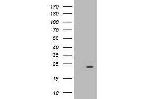 Western Blotting (WB) image for anti-Muscle RAS Oncogene Homolog (MRAS) antibody (ABIN1499553) (MRAS 抗体)