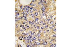 Immunohistochemistry (Paraffin-embedded Sections) (IHC (p)) image for anti-SMAD Specific E3 Ubiquitin Protein Ligase 1 (SMURF1) (AA 66-96), (N-Term) antibody (ABIN388828)