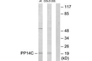 Western Blotting (WB) image for anti-Protein Phosphatase 1, Regulatory (Inhibitor) Subunit 14C (PPP1R14C) (AA 51-100) antibody (ABIN2889685) (PPP1R14C 抗体  (AA 51-100))