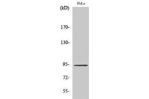 Western Blotting (WB) image for anti-Signal Transducer and Activator of Transcription 6, Interleukin-4 Induced (STAT6) (Tyr125) antibody (ABIN3187093) (STAT6 抗体  (Tyr125))